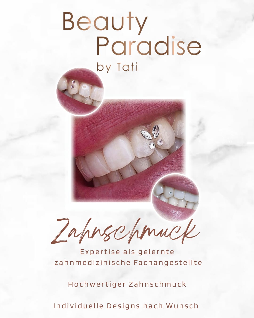 Zahnschmuck